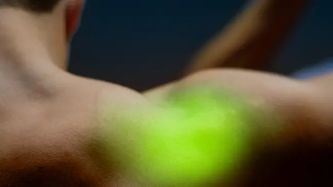 High Intensity Laser Therapy on Shoulder