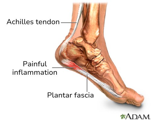 illustration of foot showing Achilles tendon and plantar fascia